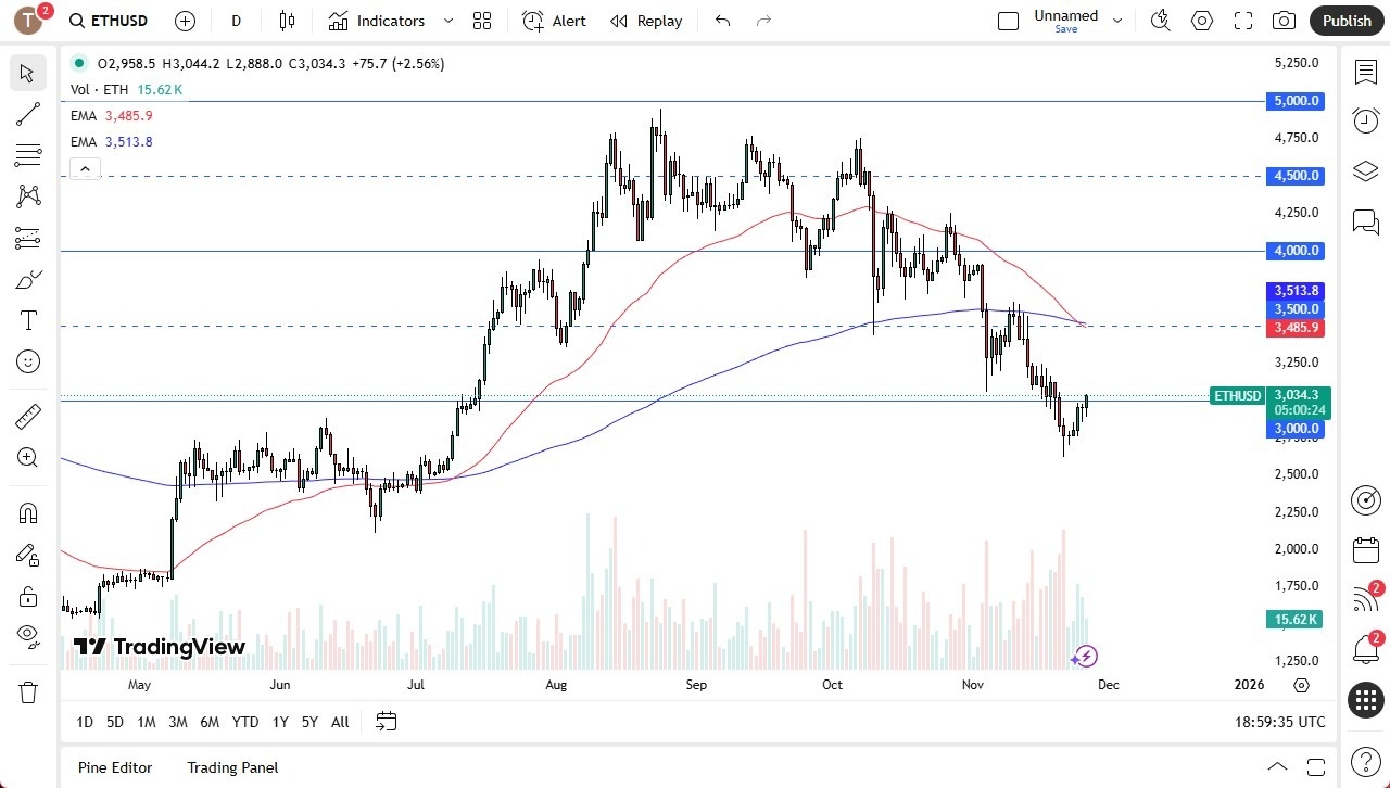 【XM Group】--ETH/USD Forecast: Fight Back Against Recent Trend(图1)